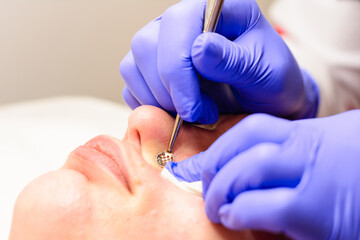 Beautician using a mechanical tool with a spoon to remove uno and clean acne on the patient's face in a beauty salon, facial care.