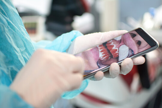 Closeup of dentists hands in protective latex gloves holding smartphone with displayed patient's teeth ready for surgery.