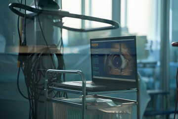 Laptop with photo of eye on screen in clinic