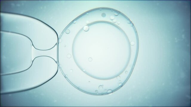 In vitro fertilization. Representation of needle putting sperm into human egg cell.