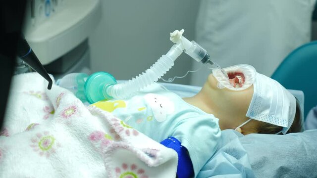 Dental treatment on child under generalanesthesia. Dentist doctor treats teeth of girl. Team of professional dental surgeons performing invasive operations on patient with general anesthesia. 4 k