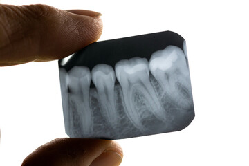 The dentist holds an X-ray of the teeth of the lower jaw. Diagnosis and treatment of teeth.