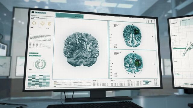 Futuristic Computer interface of the diagnosis system. Computer interface of the medical tech dealing with the diagnosis process. Computer interface of the diagnosis system identifies brain tumors. UI