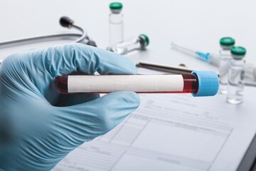 Pcr.
