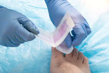 The doctor removes hair from toes with epilating wax strips. Hygiene and cosmetology concept,...