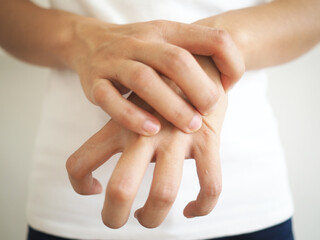 Asian hand muscle spasm . disorder of one hand. abnormally bent fingers on a white background.