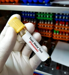Blood sample for Toxic Metal (Polonium) test. Diagnosis of polonium toxicity