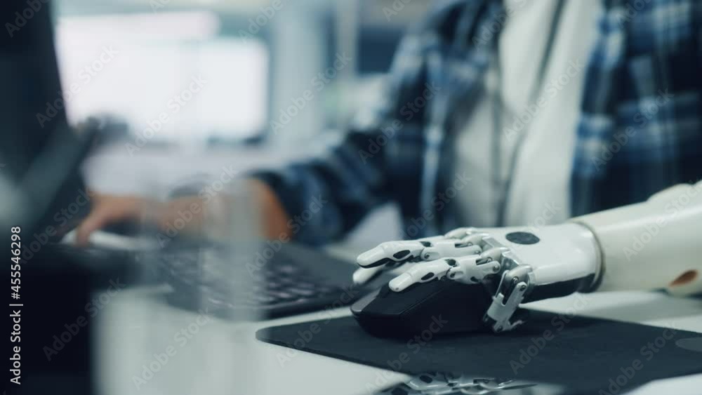 Poster Inclusive Office: Person with Disability Using Prosthetic Arm to Work on Computer. Professional with Advanced Thought Controlled Body Powered Myoelectric Bionic Limb to Control Mouse. Focus on Hands