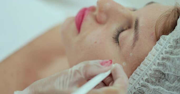 The beautician marks the injection points on the woman face with a pencil. Cosmetic treatment.