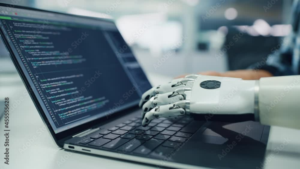 Poster Close-up on Hands: Programmer With Disability Using Prosthetic Arm to Work on Laptop Computer. Specialist Swift and Natural Use of Myoelectric Bionic Hand To Type Code for Software
