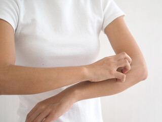 Asian woman itching and scratching on arm from itchy dry skin eczema dermatitis. closeup photo, blurred.