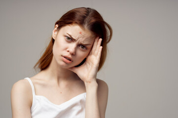 pretty woman in a white t-shirt pimples on the face light background