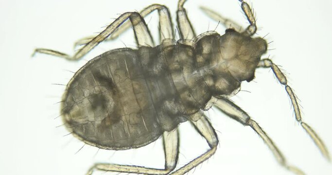 Bed bug nymph Cimex lectularius under a microscope, order Hemiptera, family Cimicidae. Feeds on human blood. Initial stage