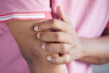 man suffering from itching skin, close up.