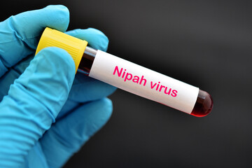 Blood sample tube positive with Nipah virus test