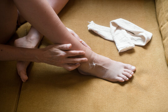 Woman applying medical cream to her injured ankle