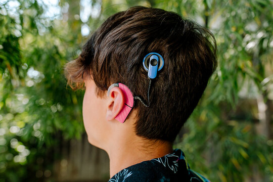 Close up of teen boy with Cochlear implants