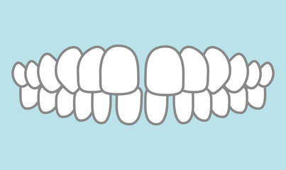 歯並びのイラスト © わさび