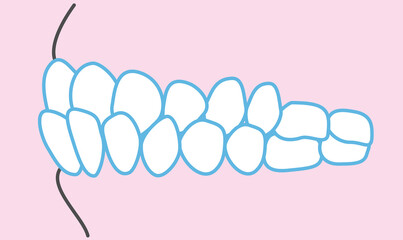 歯並びのイラスト © わさび
