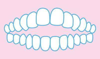 歯並びのイラスト © わさび