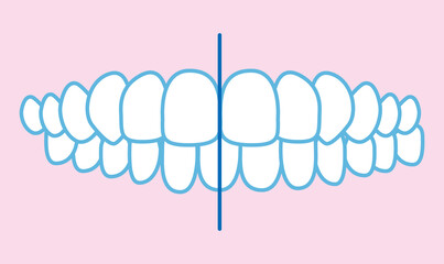 歯並びのイラスト © わさび