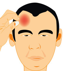 Vector illustration men beside which pain in head