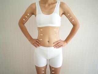 Young woman torso in underwear with the drawing arrows and medical marks. fat lose, liposuction,...