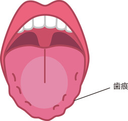 舌の健康についてのイラスト