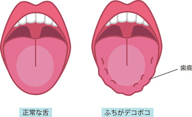 舌の健康についてのイラスト