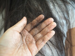 Fototapeta premium Hair loss in woman hands, hair product concept. closeup photo, blurred.
