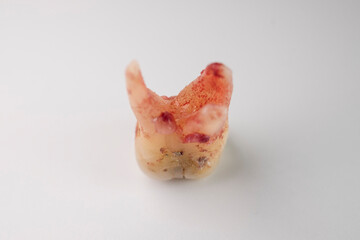 Close up of a tooth with a bit of blood stain on a white background.