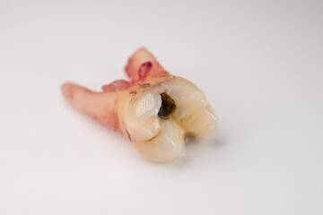 Close up of a tooth with a bit of blood stain on a white background.