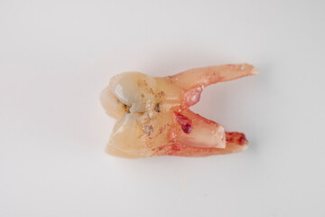 Close up of a tooth with a bit of blood stain on a white background.