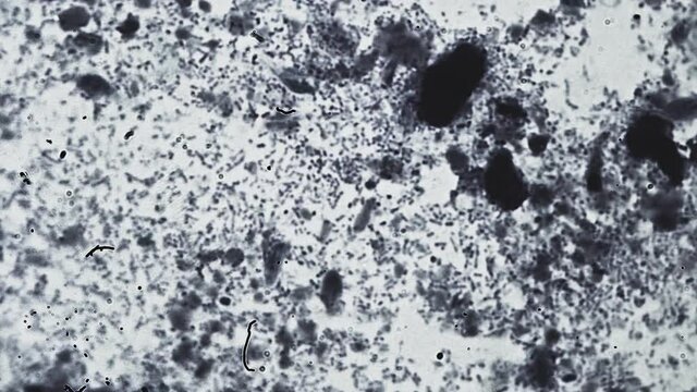 Abstract bacteria and microbes under the microscope. Fungus or mold is investigated in a scientific laboratory. Veterinary clinic, animal diseases. Microorganism cells