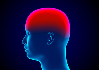 Meningitis is an inflammation of the meninges, the membranes that surround the brain and spinal cord