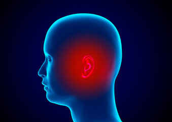 Head of a man with an earache caused by a bacterial inflammation called otitis