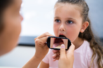 Children Throat Check For Flu