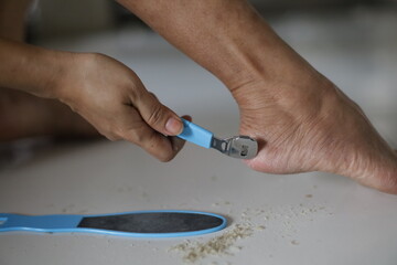 Pedicure remove dead skin on feet, women's foot care