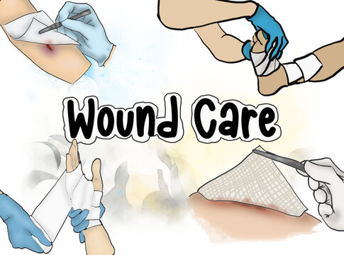 Wound Dressing Clipart Transparent PNG Hd, Wound Dressing Steps ...