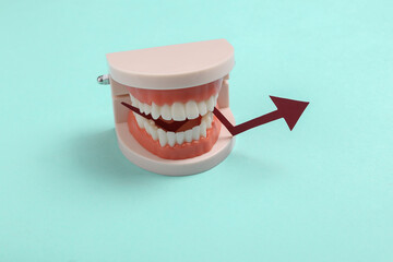 Plastic model of human jaw with growth arrow in the teeth on blue background