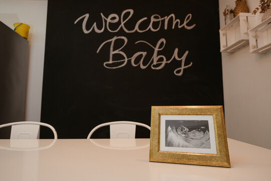 Welcome Baby title on blackboard against ultrasound picture