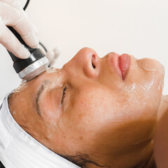 esthetic radiofrecuency treatment on the skin dermatology