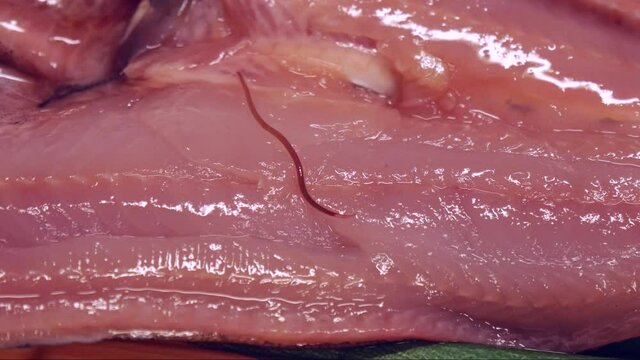 魚に寄生するシュードテラノーバ　	アニサキス症のイメージ素材