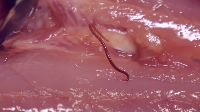魚に寄生するシュードテラノーバ　	アニサキス症のイメージ素材