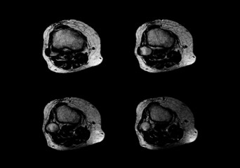 Mri and Ct Scan images with bone and brain
