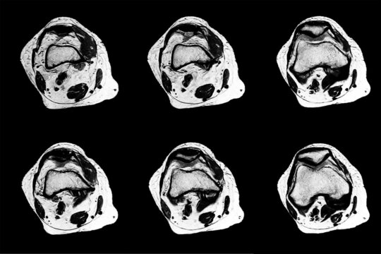 Mri and Ct Scan images with bone and brain