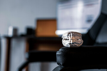 cast of plaster jaws against a computer background, the foreground and background are blurred