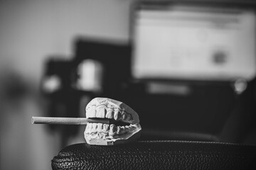 cast of plaster jaws against a computer background, the foreground and background are blurred