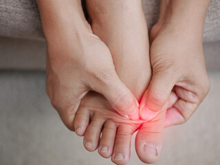 Closeup of female holding her painful feet and massaging her bunion toes to relieve pain. Swollen...