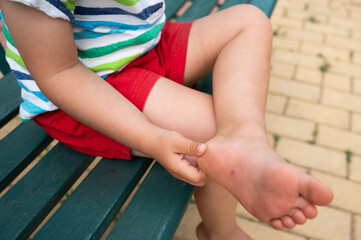 The child has hurt his foot